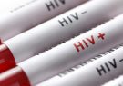 شناسایی 207 مورد ابتلا به ایدز در کهگیلویه و بویراحمد/75 درصد الگوی انتقال از راه آمیزشی است