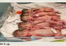 تولد 5 قلو در بیمارستان بی بی حکیمه خاتون گچساران